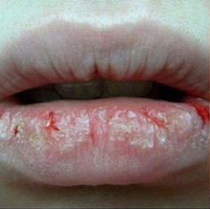 Close-up of pale lips